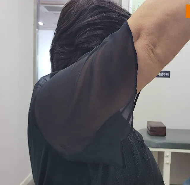 오십견으로 팔이 끝까지 올라가지 않는 모습